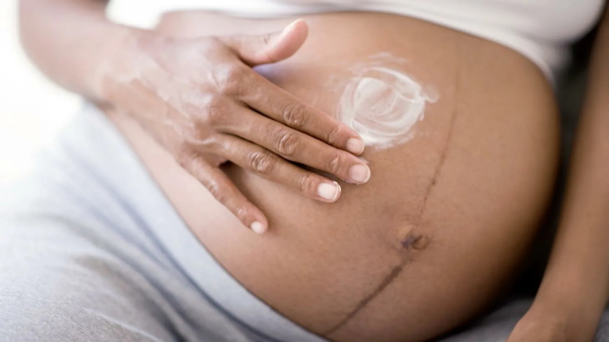Темная линия на животе при беременности
